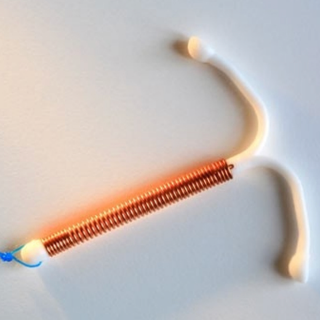 İpi Kopmuş RİA Nasıl Çıkarılır? Ofis Histeroskopi ile Güvenli Çözüm